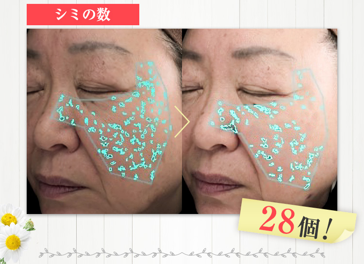 28個減少